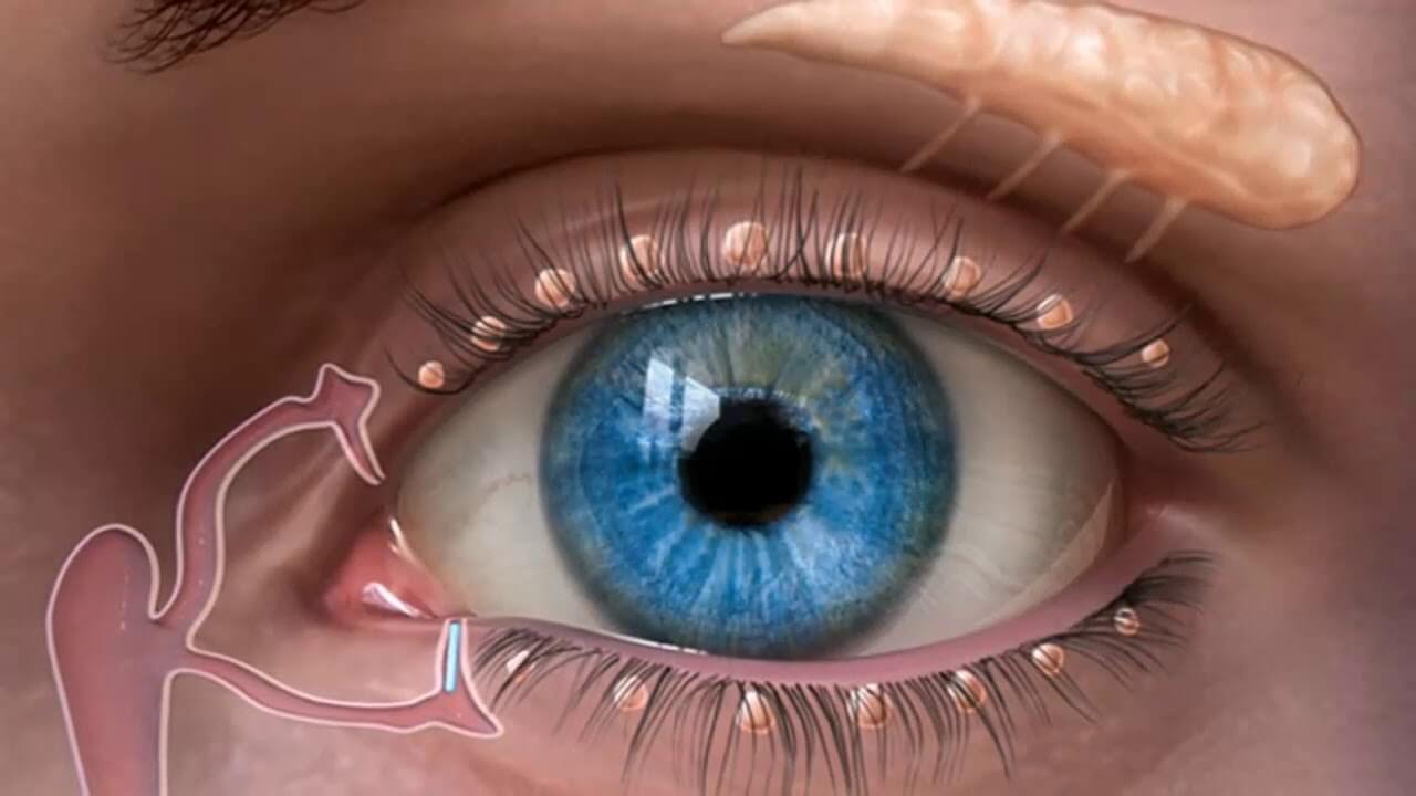 ما سبب جفاف العين