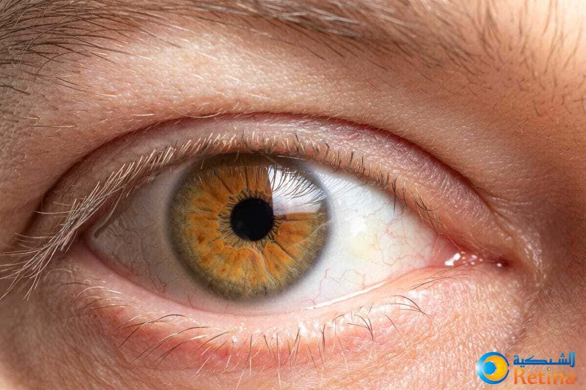 أفضل علاج لتقوية شبكية العين